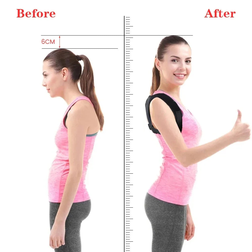 Posture Corrector — Adjustable Back & Shoulder Support